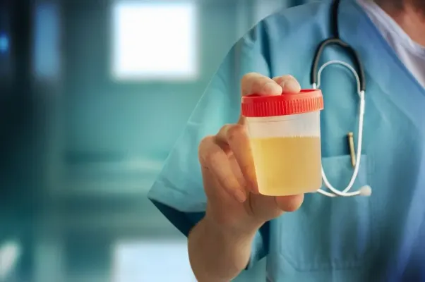 رائحة البول الكريهة عند الرجال: الأسباب، الأعراض، وطرق العلاج