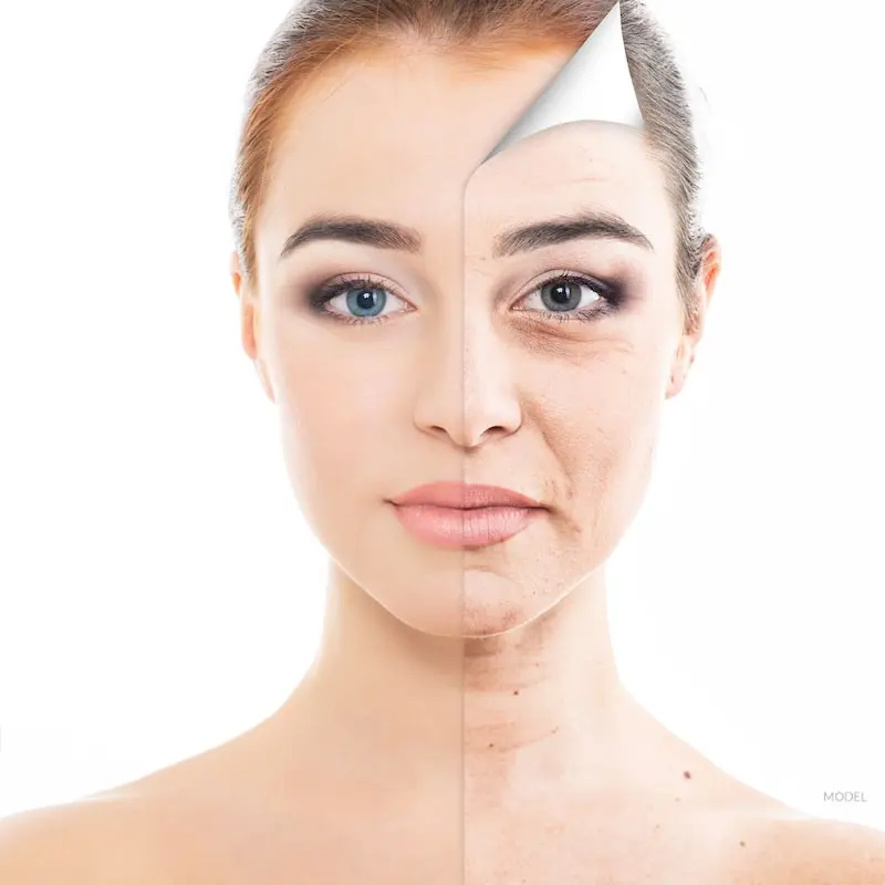 Facelift & Facial Rejuvenation Iran