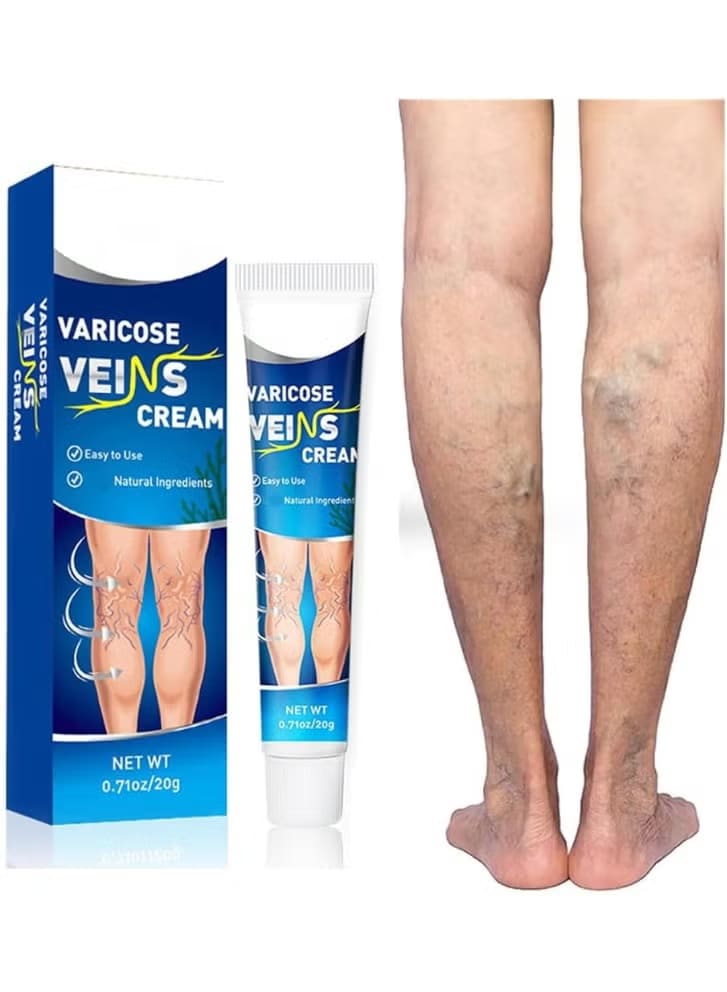Varicose Vein Cream For Legs, Improves Blood-Circulation, Reduces Spider Veins And Heaviness, Improve Blood-Circulation, Tired And Heavy Legs, 20G