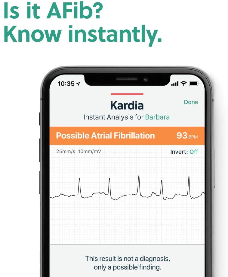 AliveCor KardiaMobile Personal EKG Optum Store