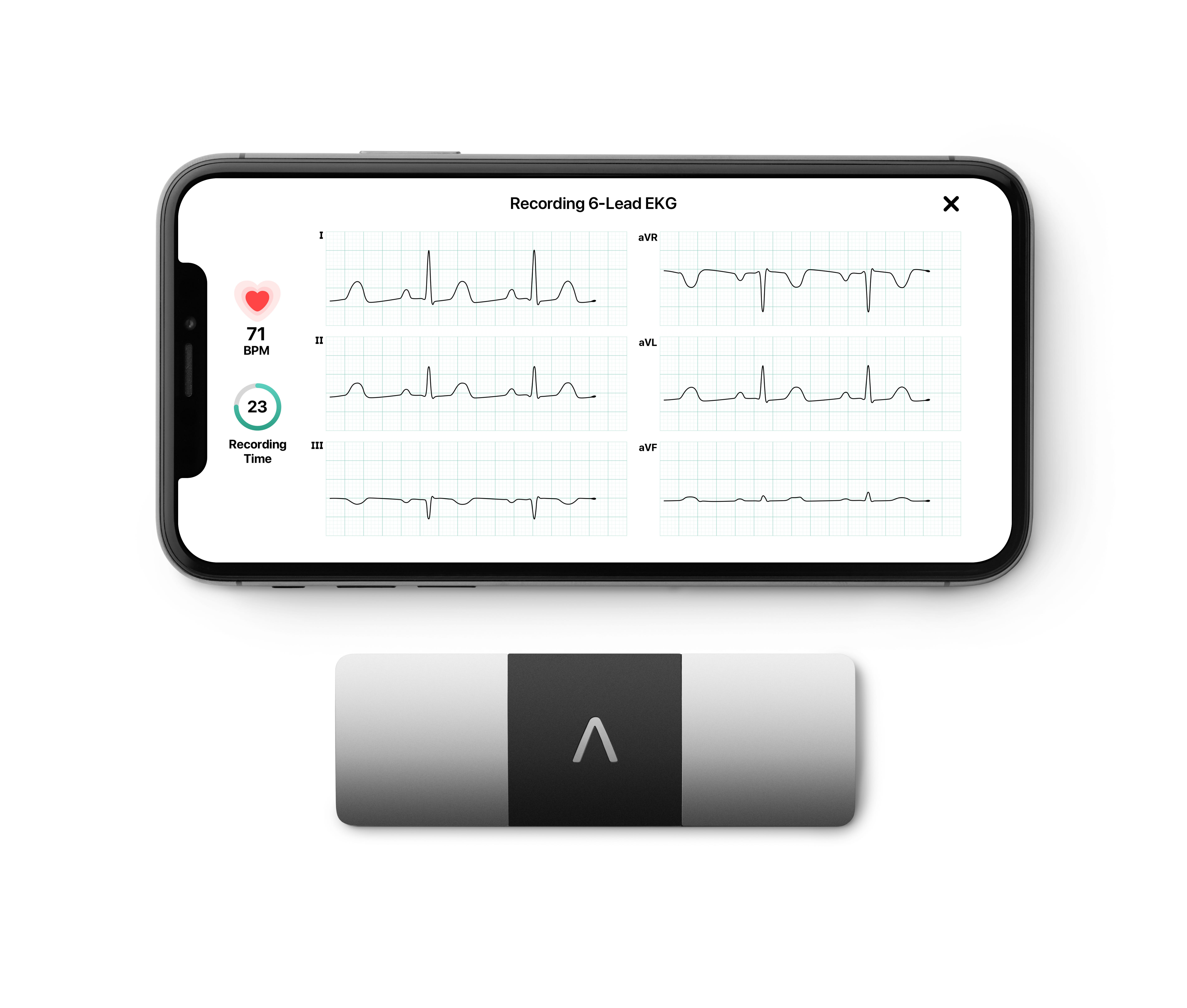 Alivecor Kardiamobile 6l Personal Ekg Device Optum Store 