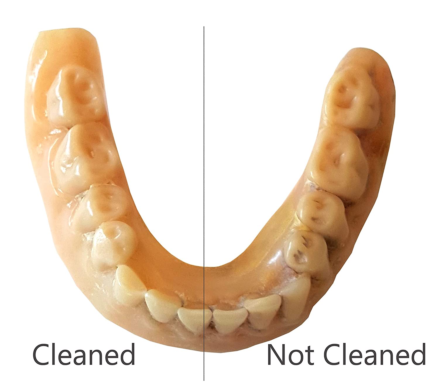 iSonic Ultrasonic Denture & Retainer Cleaner F3900 Optum Store