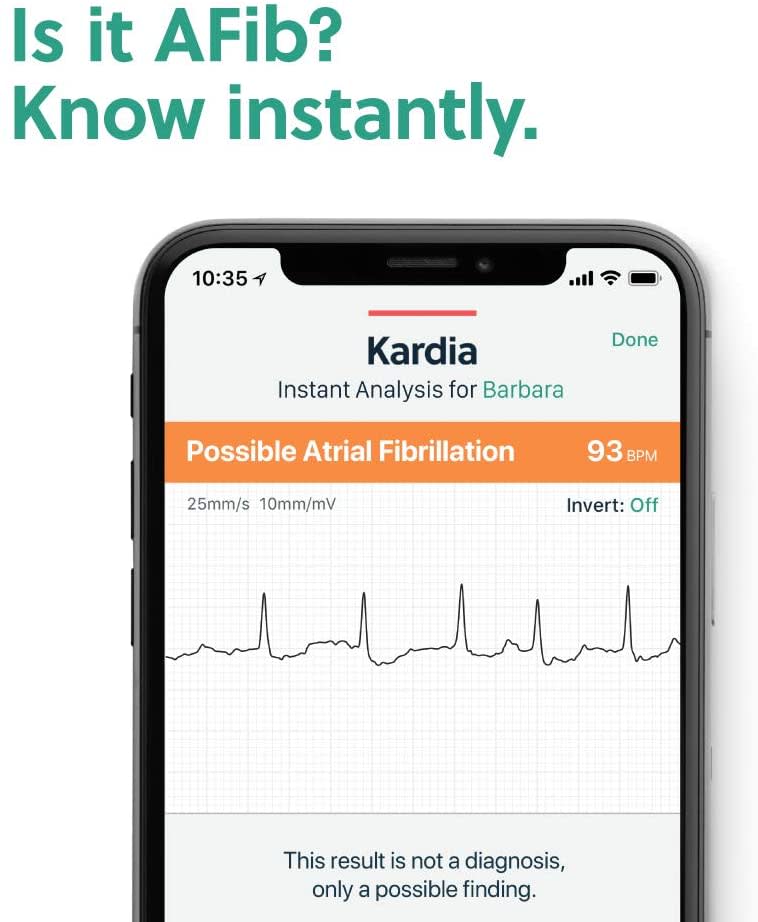 AliveCor - KardiaMobile Personal EKG Monitor - Black Model:AC-009