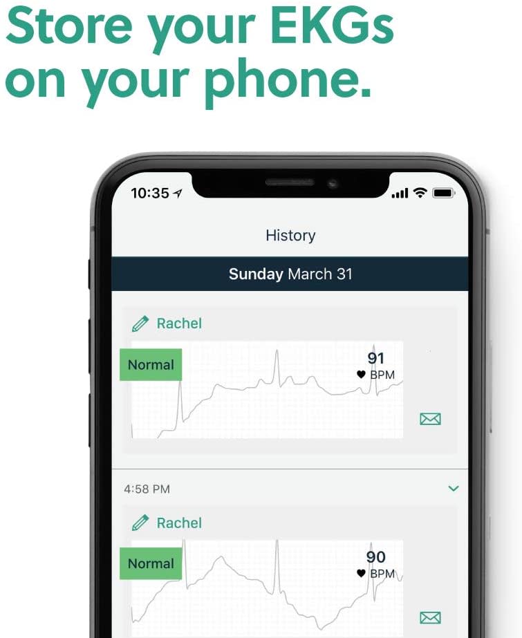 AliveCor KardiaMobile Personal EKG