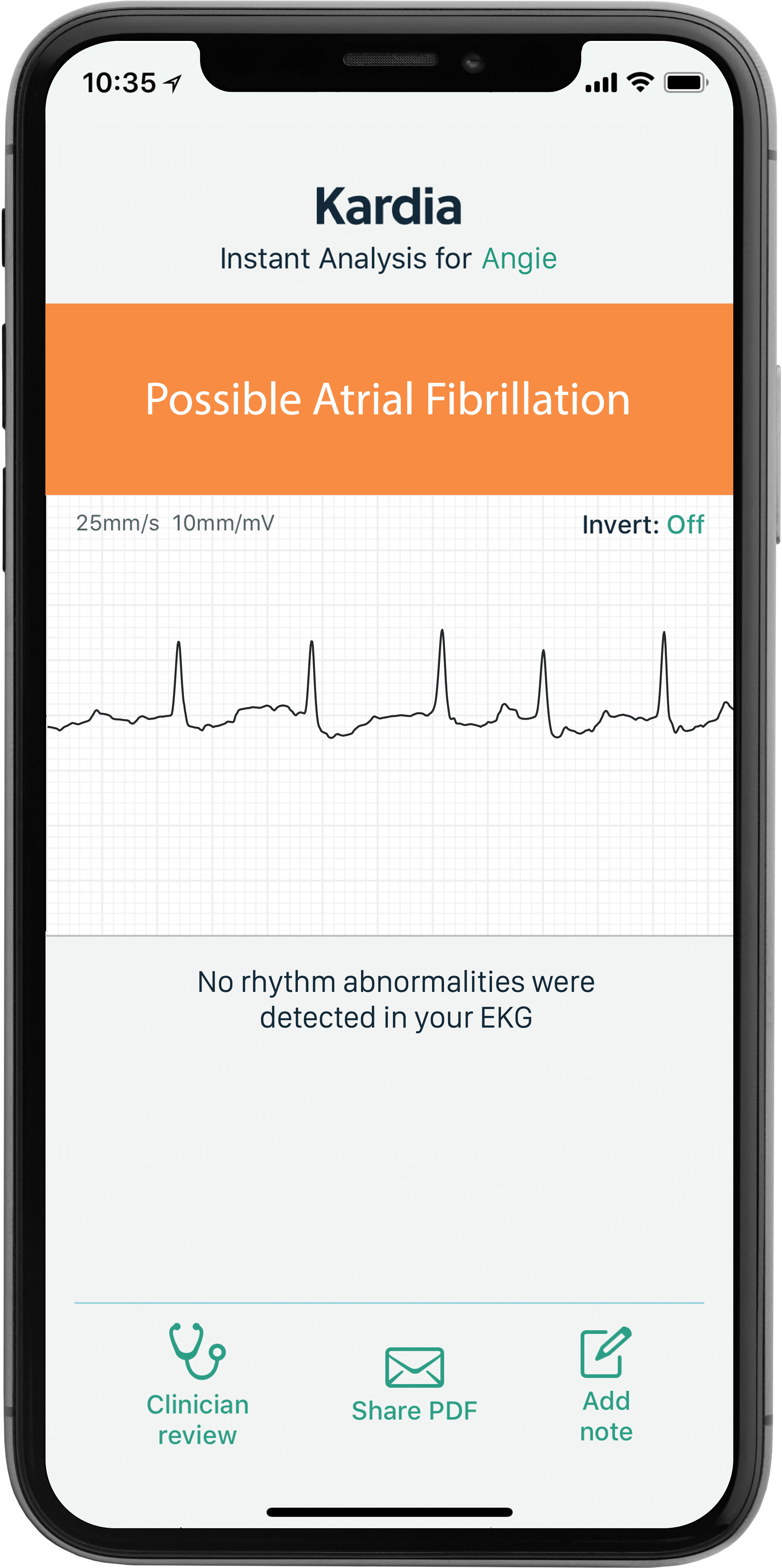 Heart Health and Kardiamobile: A Comprehensive Overview