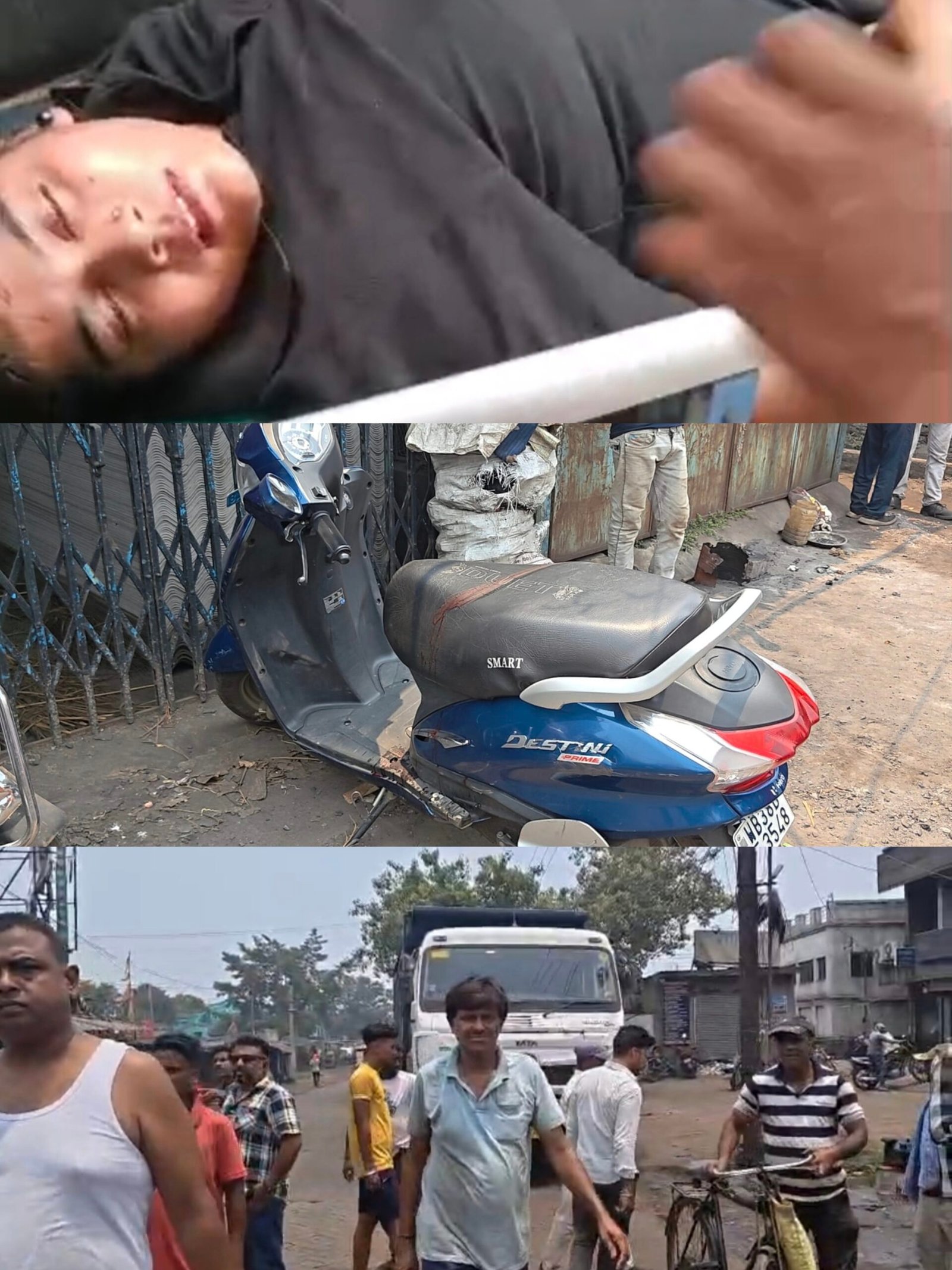 A young woman riding a scooty was seriously injured after being hit by a coal-laden dumper of ECL, sparking outrage over the 'no-entry' policy