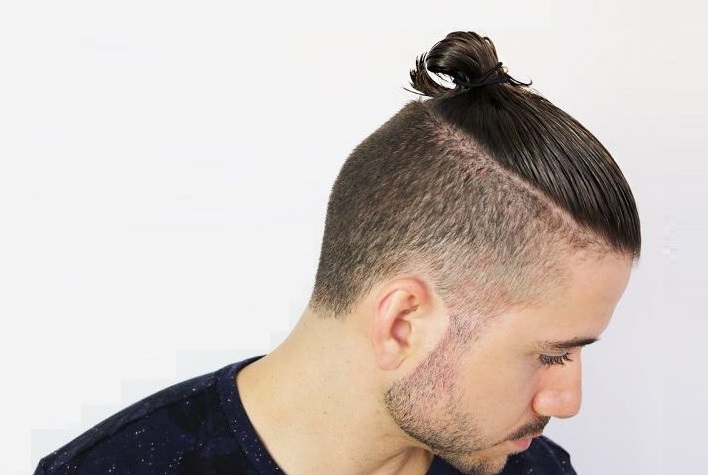 Kiểu tóc búi Undercut