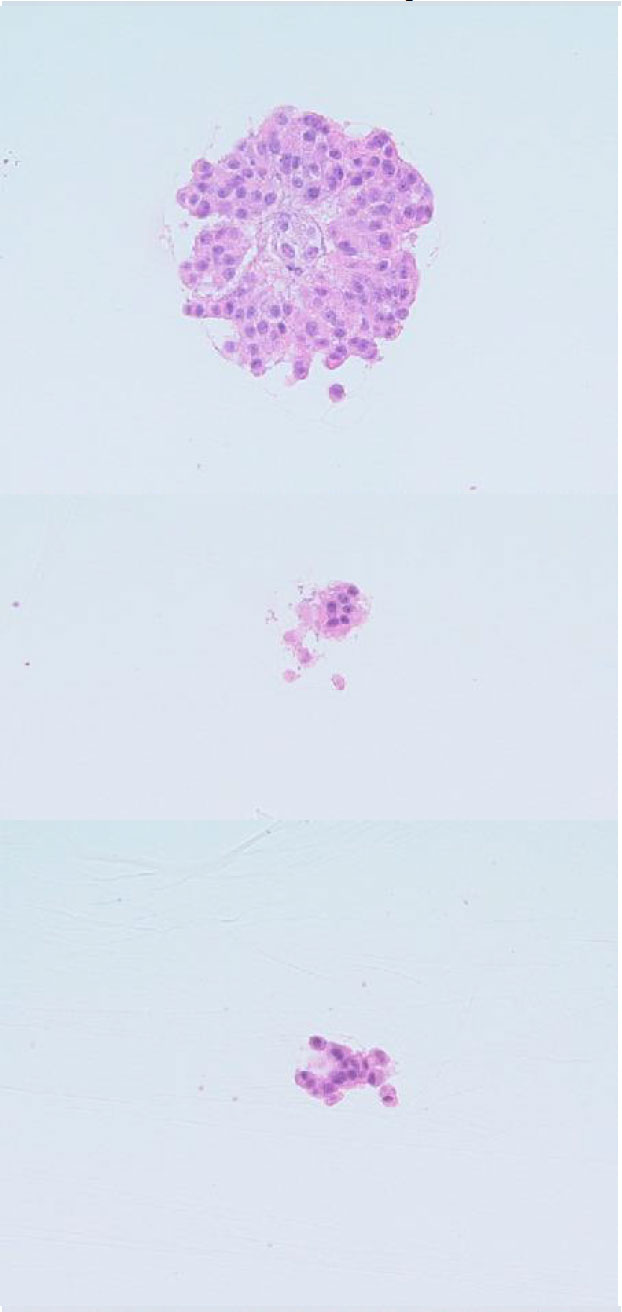 Hyperglycemia hospital protocol picture