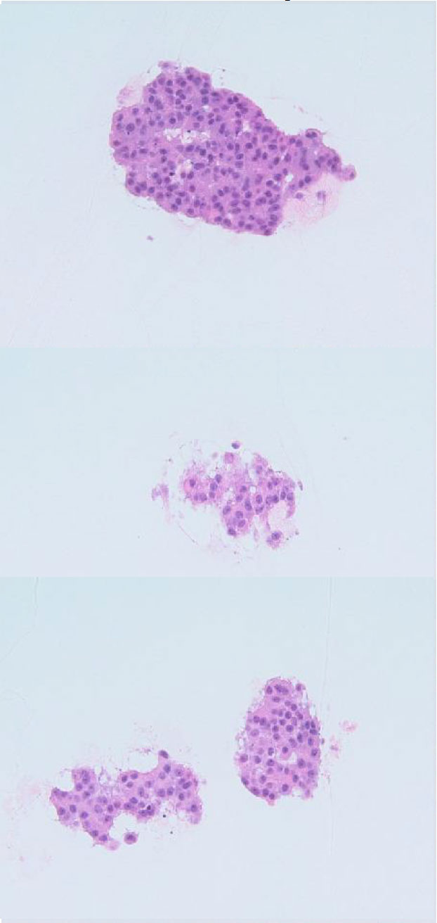 Insulin therapy ppt 2019 image