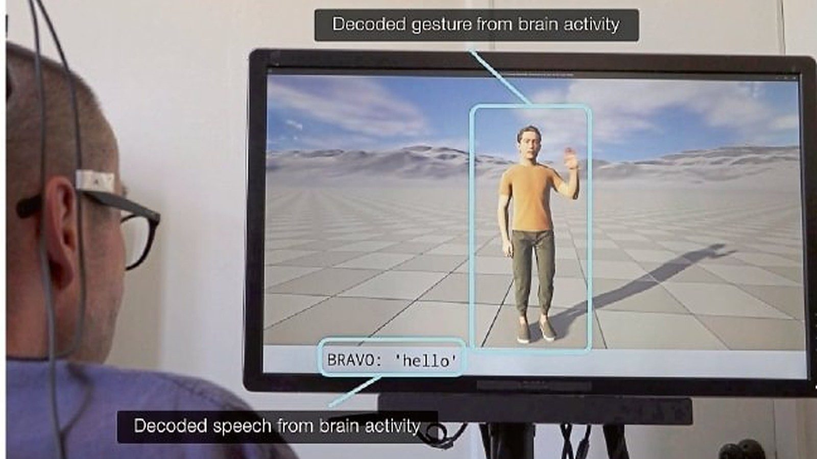Un implante cerebral devuelve habla y gestos a la vez a personas con parálisis