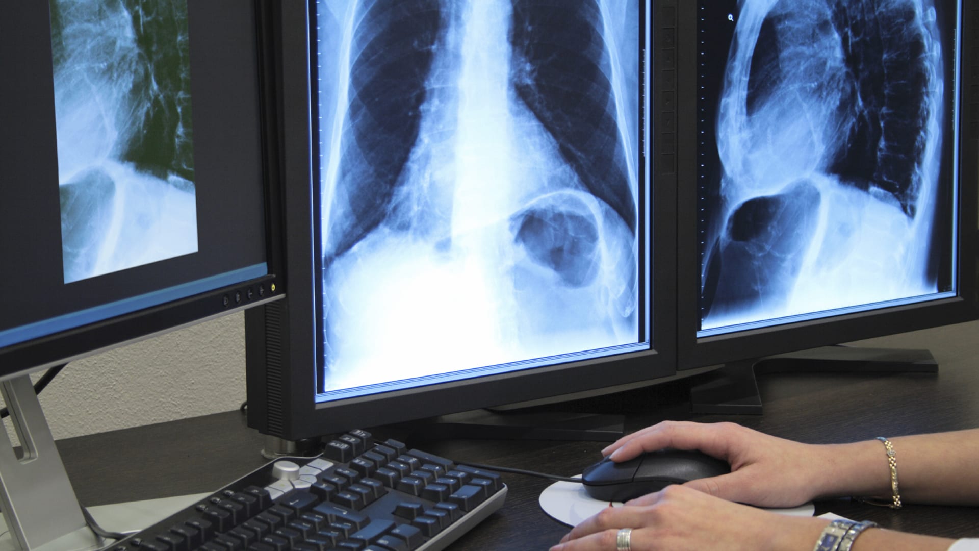Medical Center Solves Radiology Slowdown Issue with Proactive Observability
