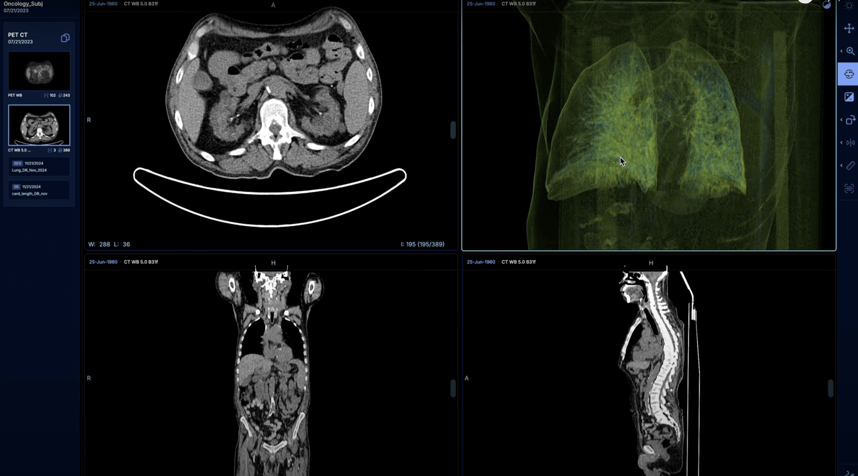 The ability to display a 3D reconstruction of a lung image is shown.