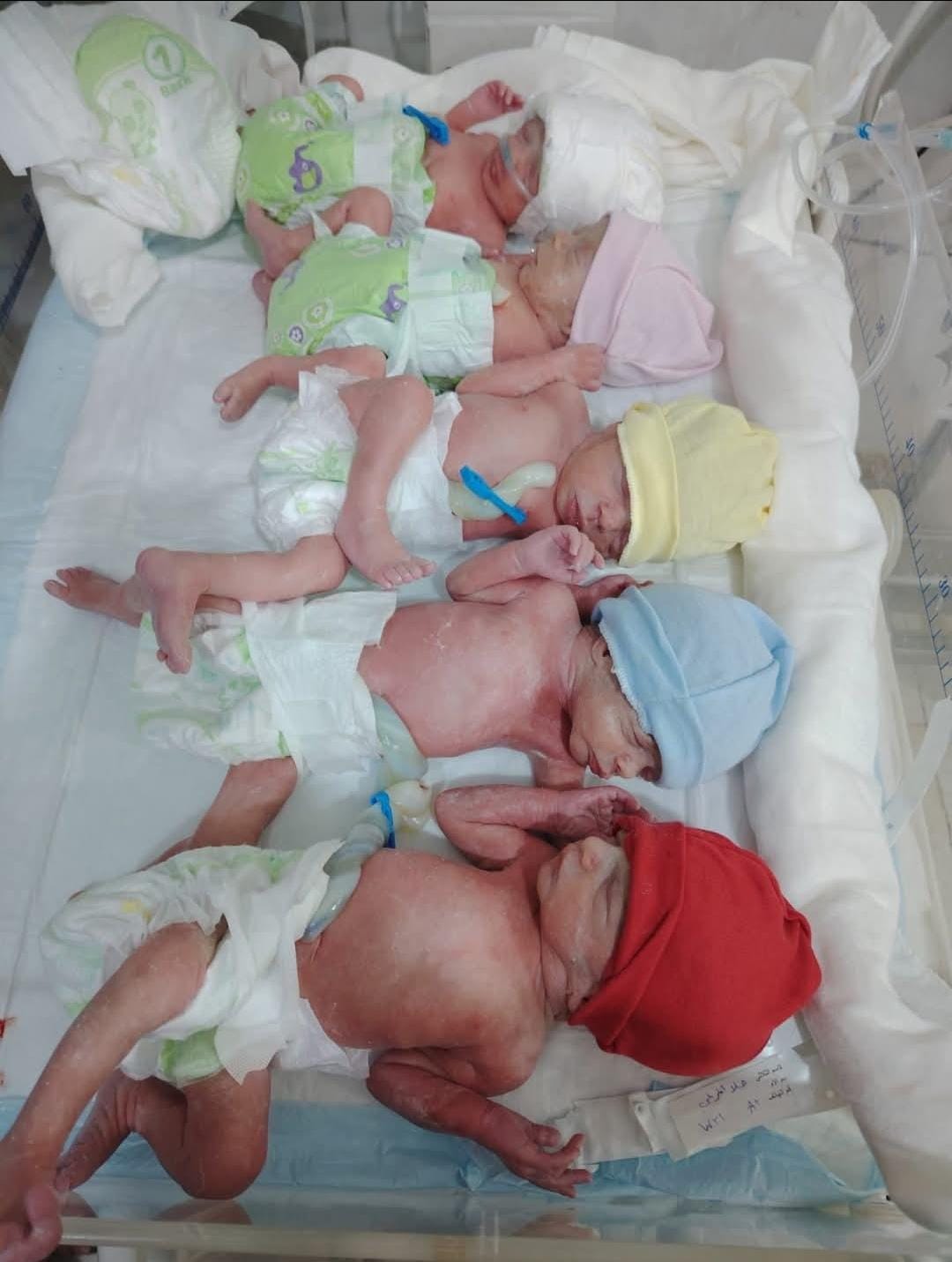 Rare birth of sextuplets in Idlib.. The children with special needs require urgent support