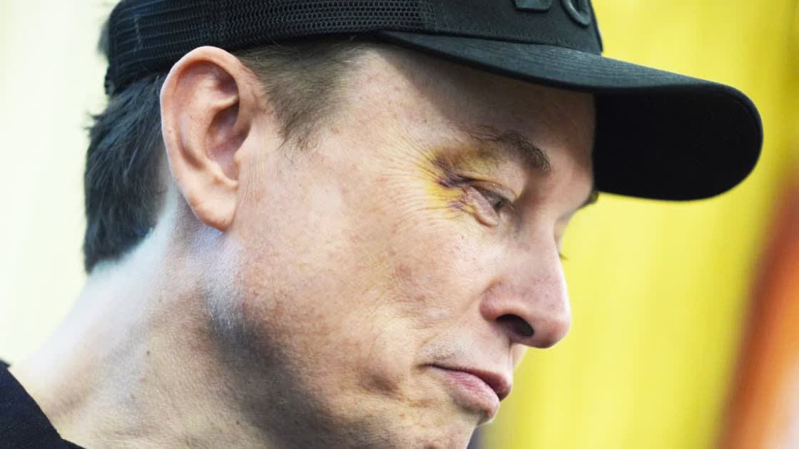 Covering his eye bruise: X is the reason.. and "France" is innocent