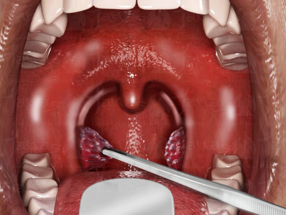 A realistic scientific anatomical surgery medical illustration Upwork