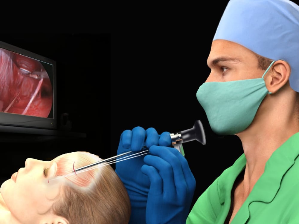 A realistic scientific anatomical surgery medical illustration Upwork