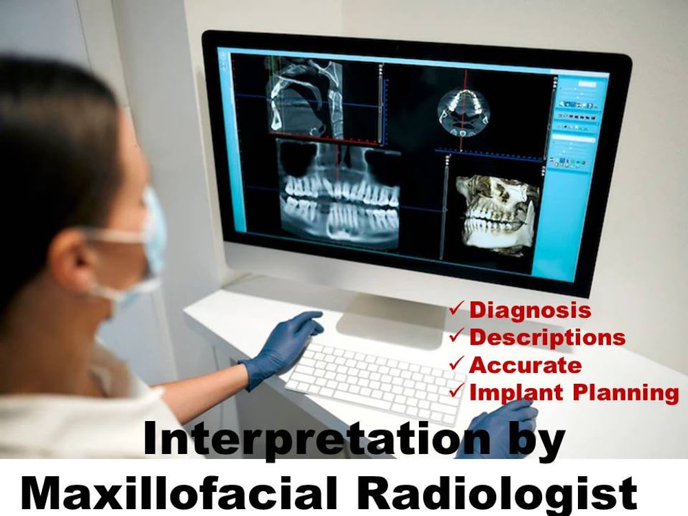 Interpretation I Annotation for Dental Radiographs (2D/3D CBCT) Upwork