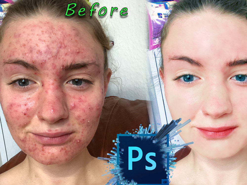 Face Editing project, skin restoration and background removal | Upwork