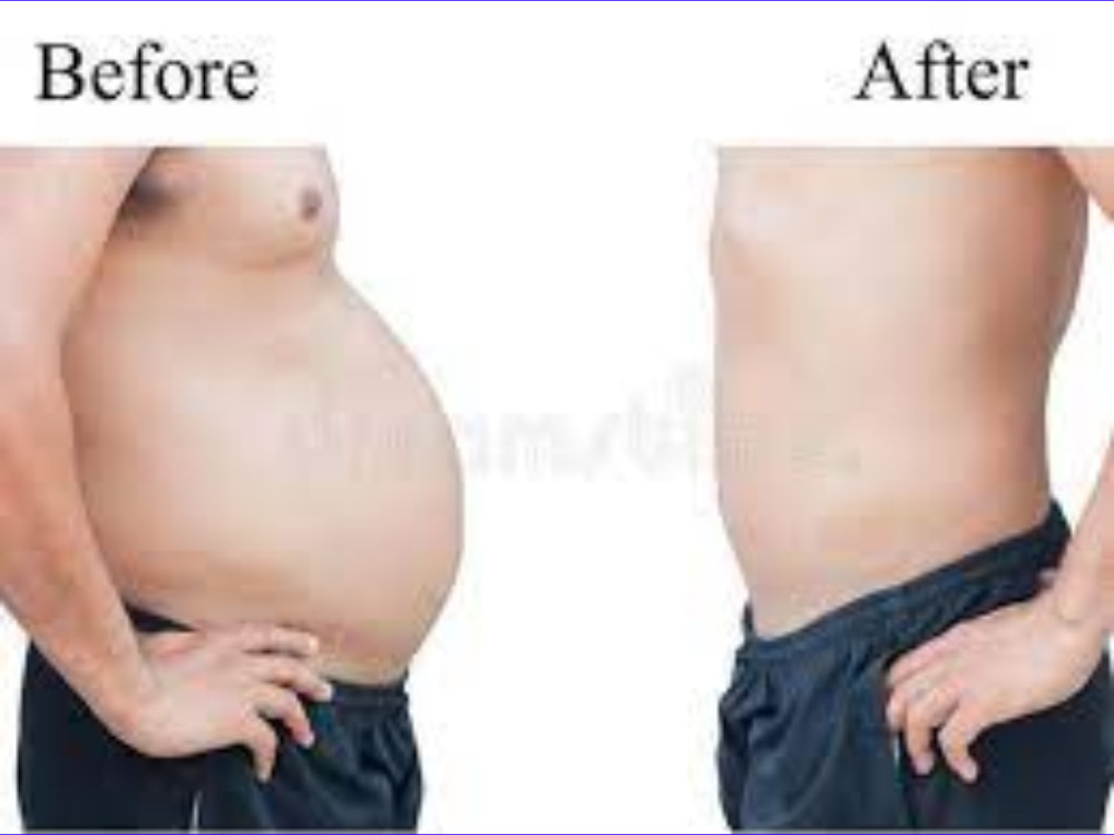 Body Contouring & Slimming Program