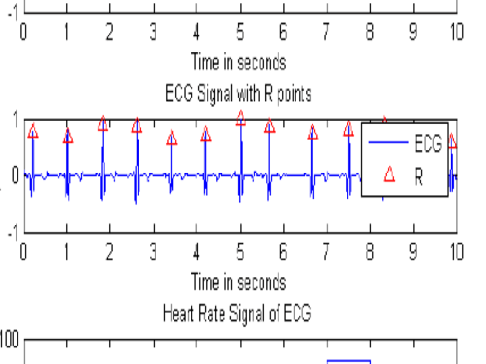Code in MATLAB of Electrical Engineering | Upwork