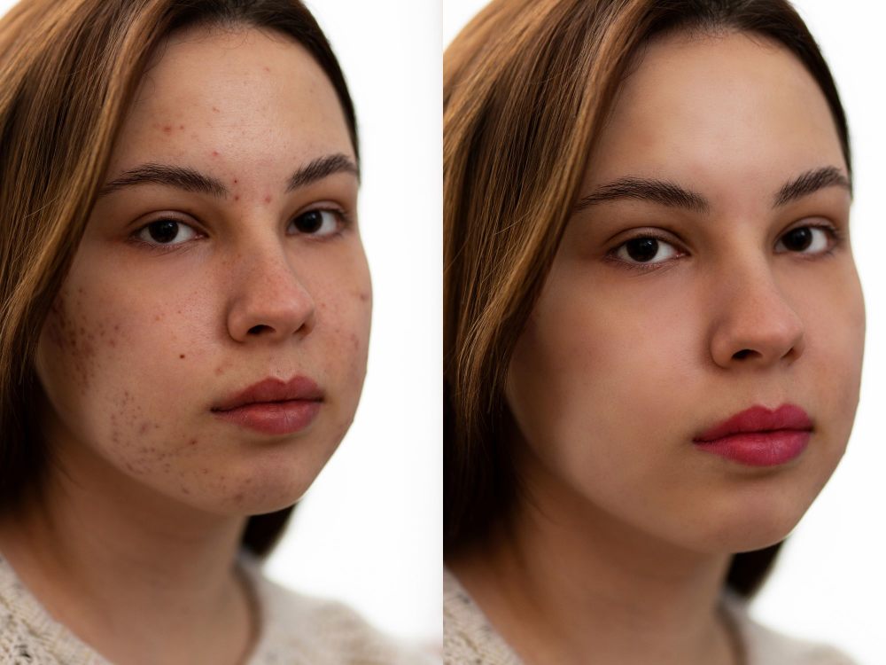 Professional Photo Retouching and Model Editing | Upwork