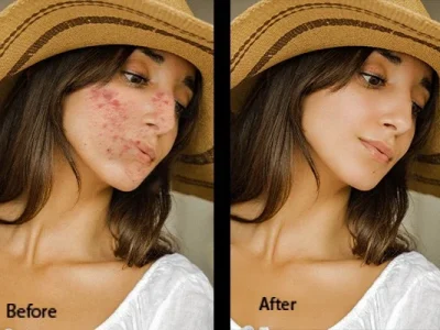 A professional skin retouching service