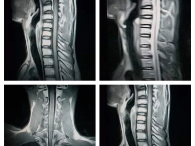 Your CT/MRI/Xray reported or reviewed for a second opinion.