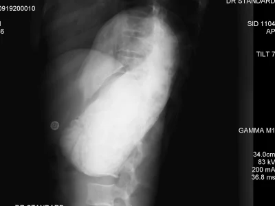 A chance to discuss your CT scan MRI Dicom images on live video call.