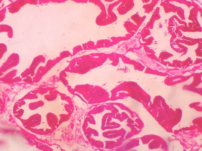 Prefect tutoring on any topic in histology, pathology or radiology