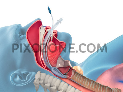 Medical Illustration and Scientific Illustration