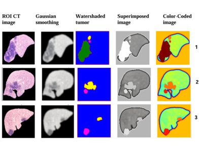Image Segmentation using Machine Learning with Annotation and Report ...