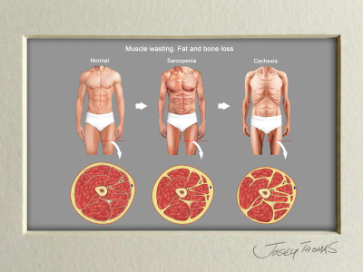 Medical Illustrations with Scientific Precision