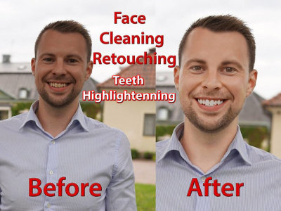 Face Cleaning/Photo Clean Up/Image Clean Up/Teeth Highlightening/Blemishes