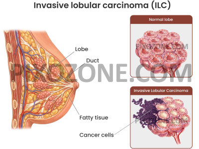 Medical Illustration and Scientific Illustration