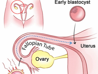 Medical illustrations: Pregnancy related