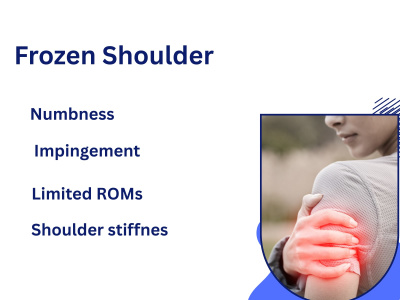 Assessment | Adhesive Capsulitis| Exercise Therapy | Mobilization