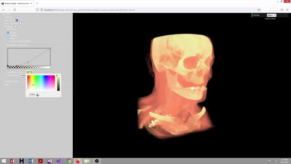 A browser based CT/MRI dataset visualizer | Upwork