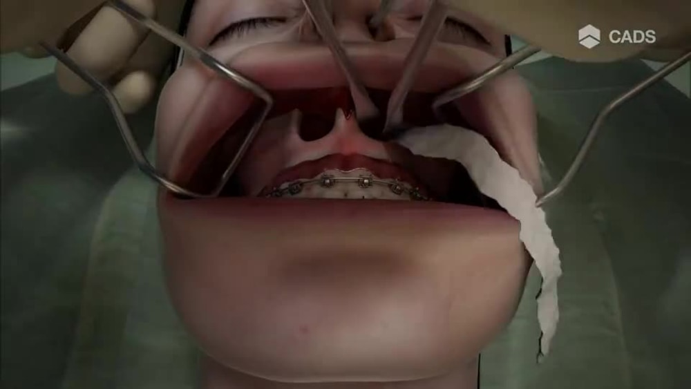 Play video