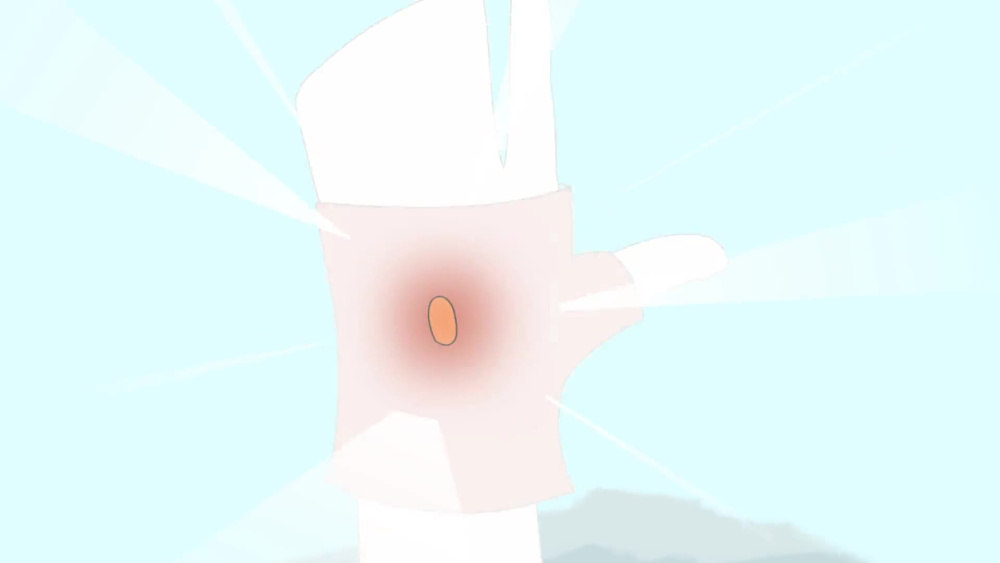 Play video