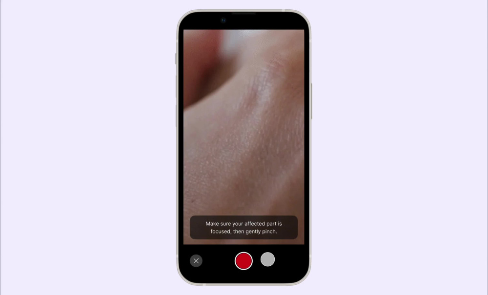 Play video