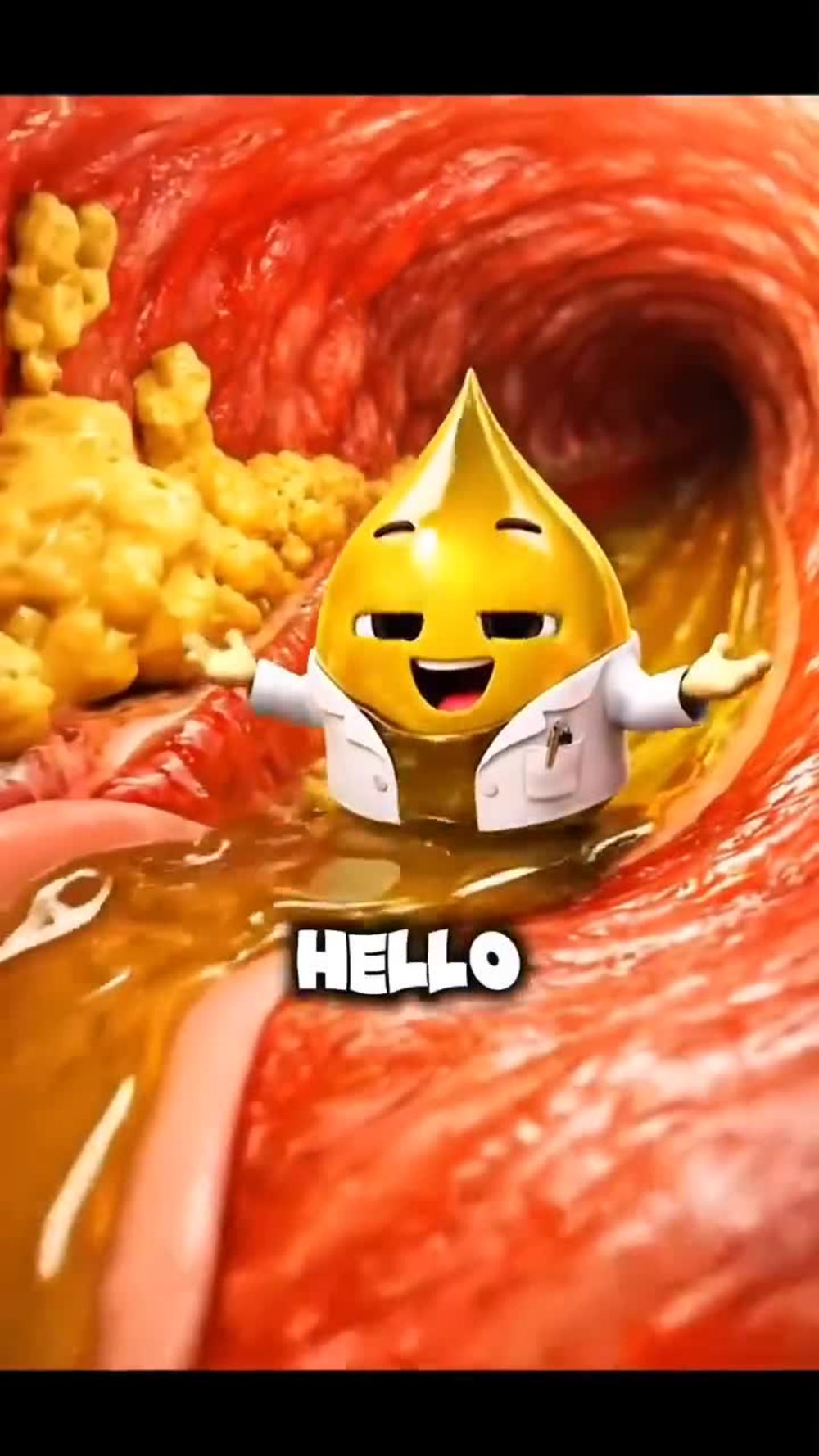 Play video