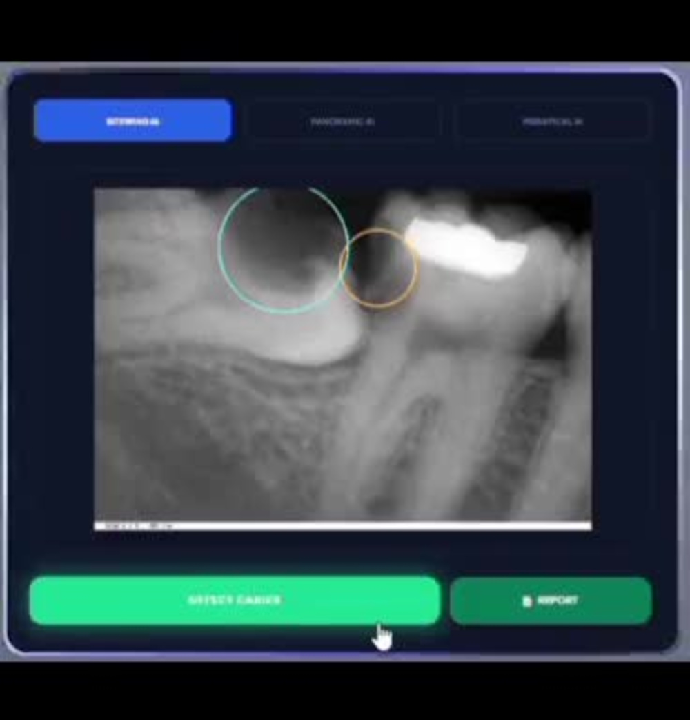 Play video