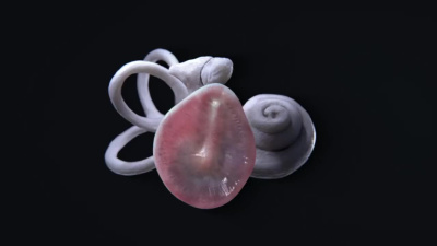 3D medical animation, surgical procedure, anatomy, medical device video