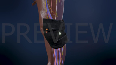 A medical device animation for FDA submissions, sales and product marketing