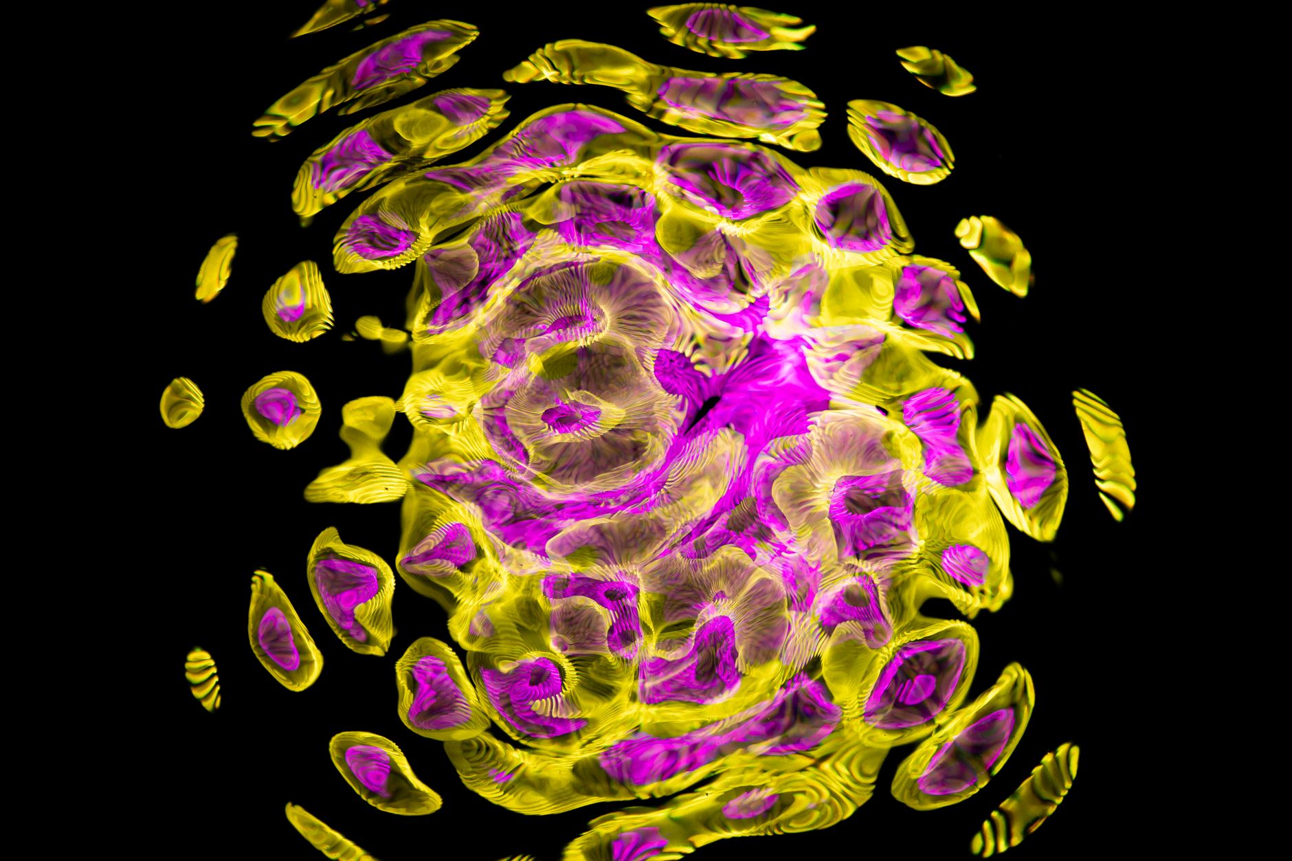 Neutrophils produce protein linked to schizophrenia