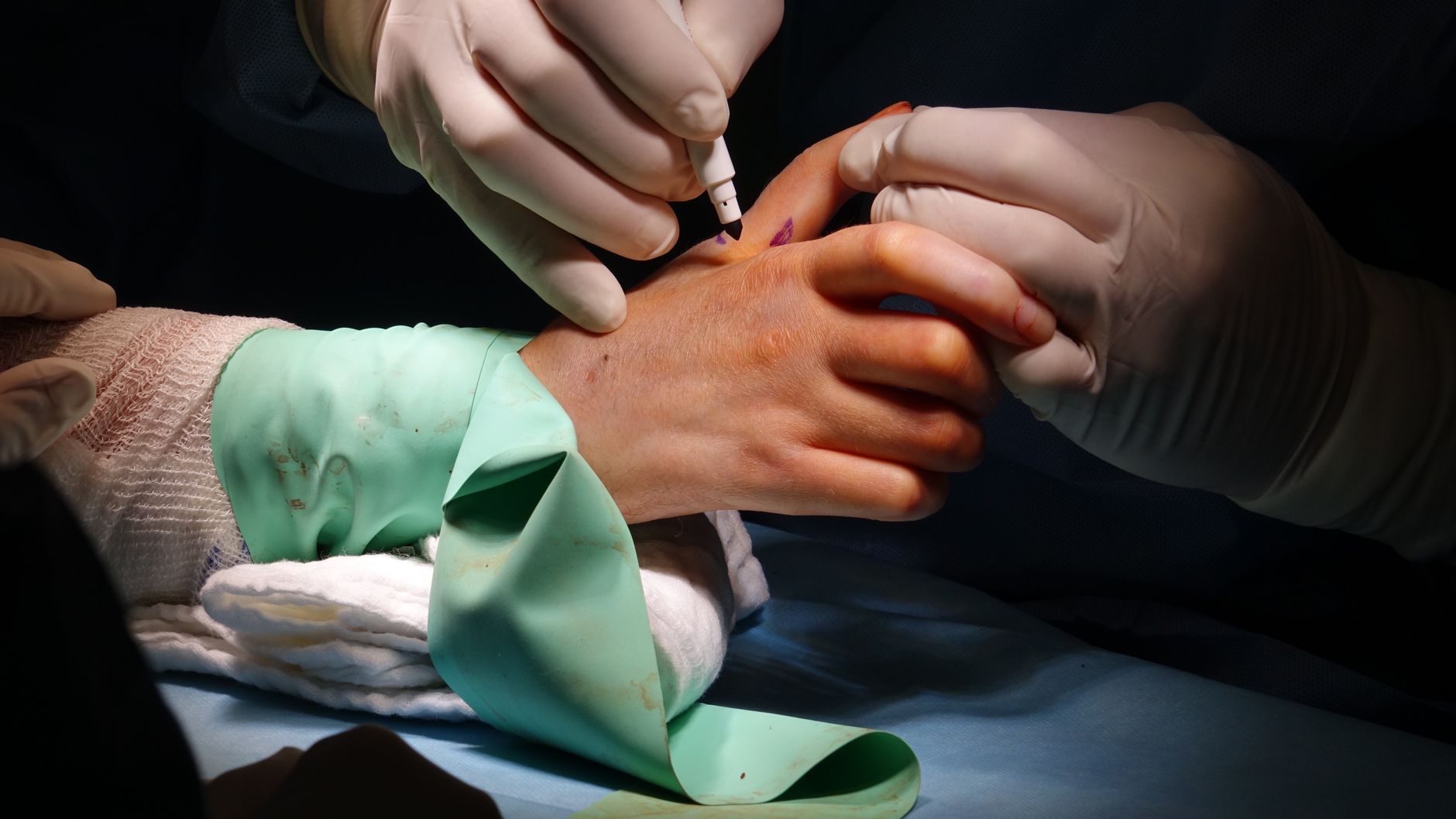 New Surgery Methods Speed Recovery Times