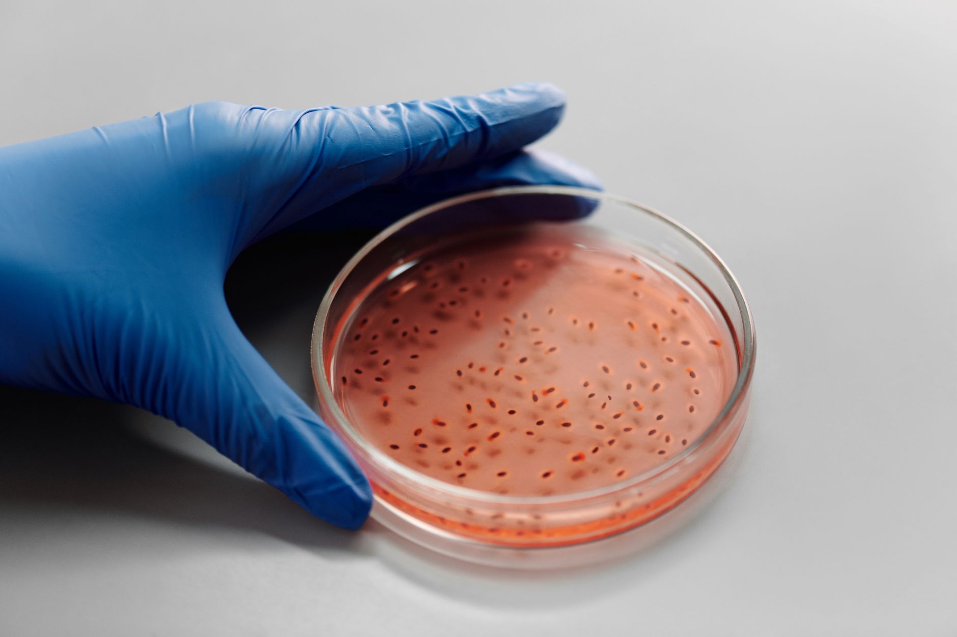 CRISPR and Hepatitis E: A New Frontier in RNA-Targeting Antiviral Therapy