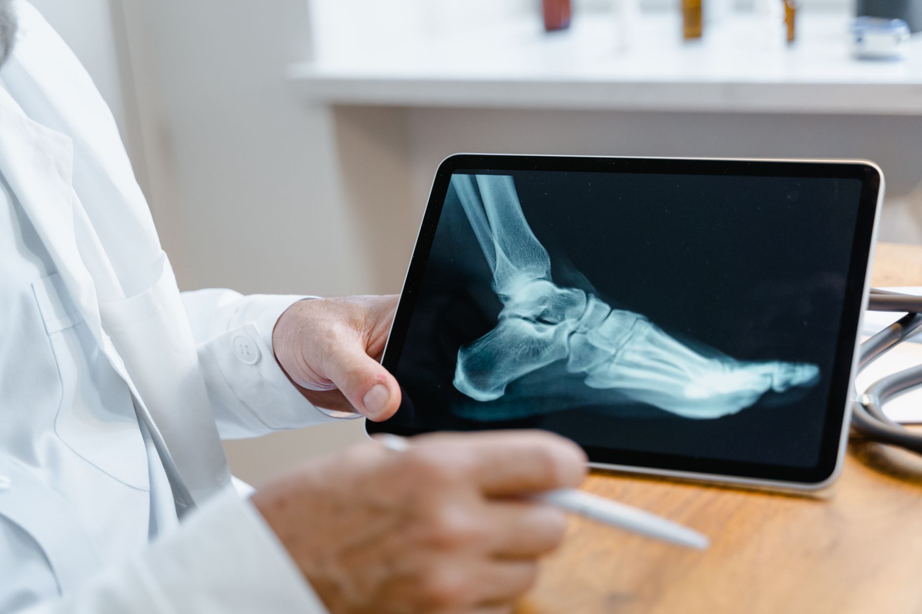 New treatment approach needed for brittle bones