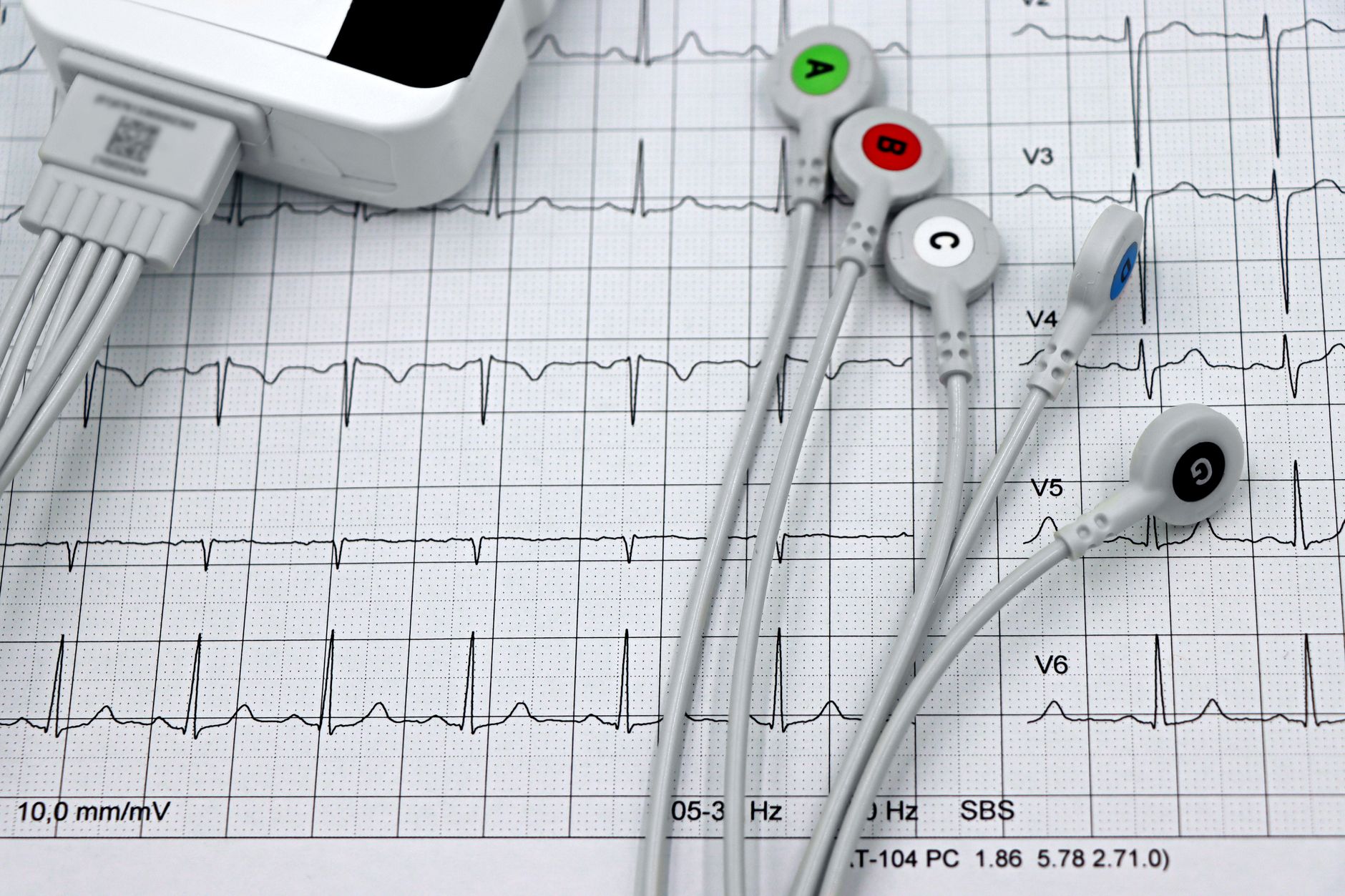 Amputation rates rise in US hospitals