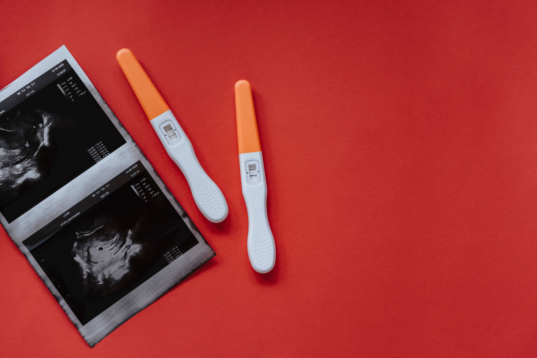 IVF in Iran: An In-Depth Exploration of Cost-Effective, High-Efficiency Fertility Treatments